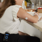 diabetes in CF